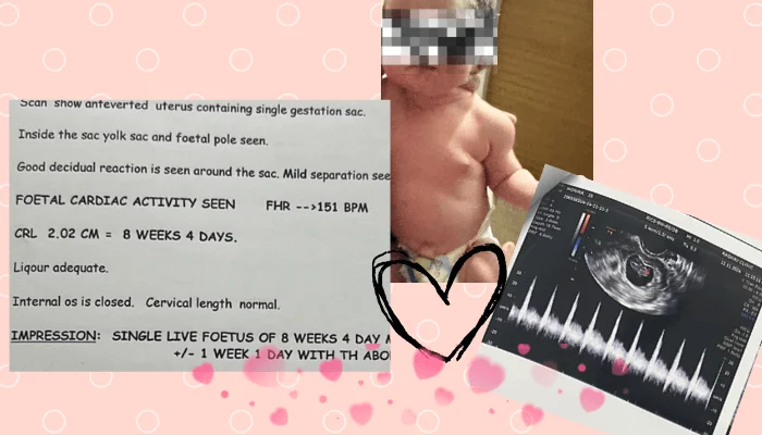 ivf success story